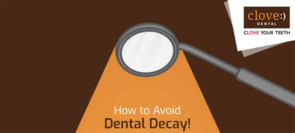 How-to-avoid-dental-decay-infographic-plaza-thumb