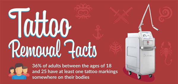 laser_tattoo_removal-infographic-plaza-thumb